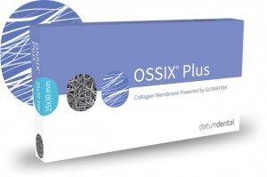 OSSIX Plus by Datum Dental